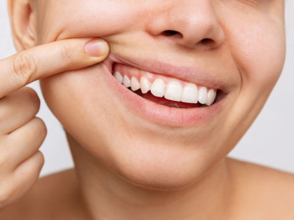 Diş Eti Hastalıkları